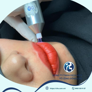 PlasmaRosy: Nhân Tố số 1 “Khóa” Biến Chứng Sau Laser Xóa Xăm Thẩm Mỹ