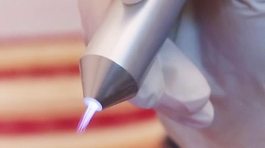 Tia Plasma lạnh làm dịu cảm giác bỏng rát ngay sau khi đi Laser, giúp khách hàng thoải mái và không còn nỗi lo "ám ảnh" sau điều trị.