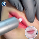 Clinic Bứt Phá Doanh Thu Nhờ Công Nghệ Plasma Lạnh Thẩm mỹ