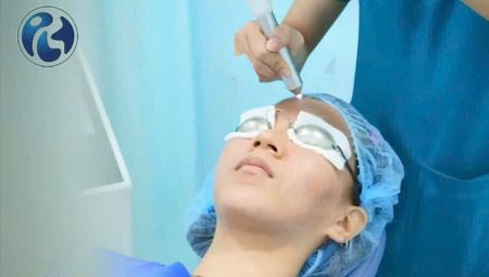 Plasma lạnh điều trị vết thương hở: Giải pháp ưu việt cho phòng khám và thẩm mỹ viện