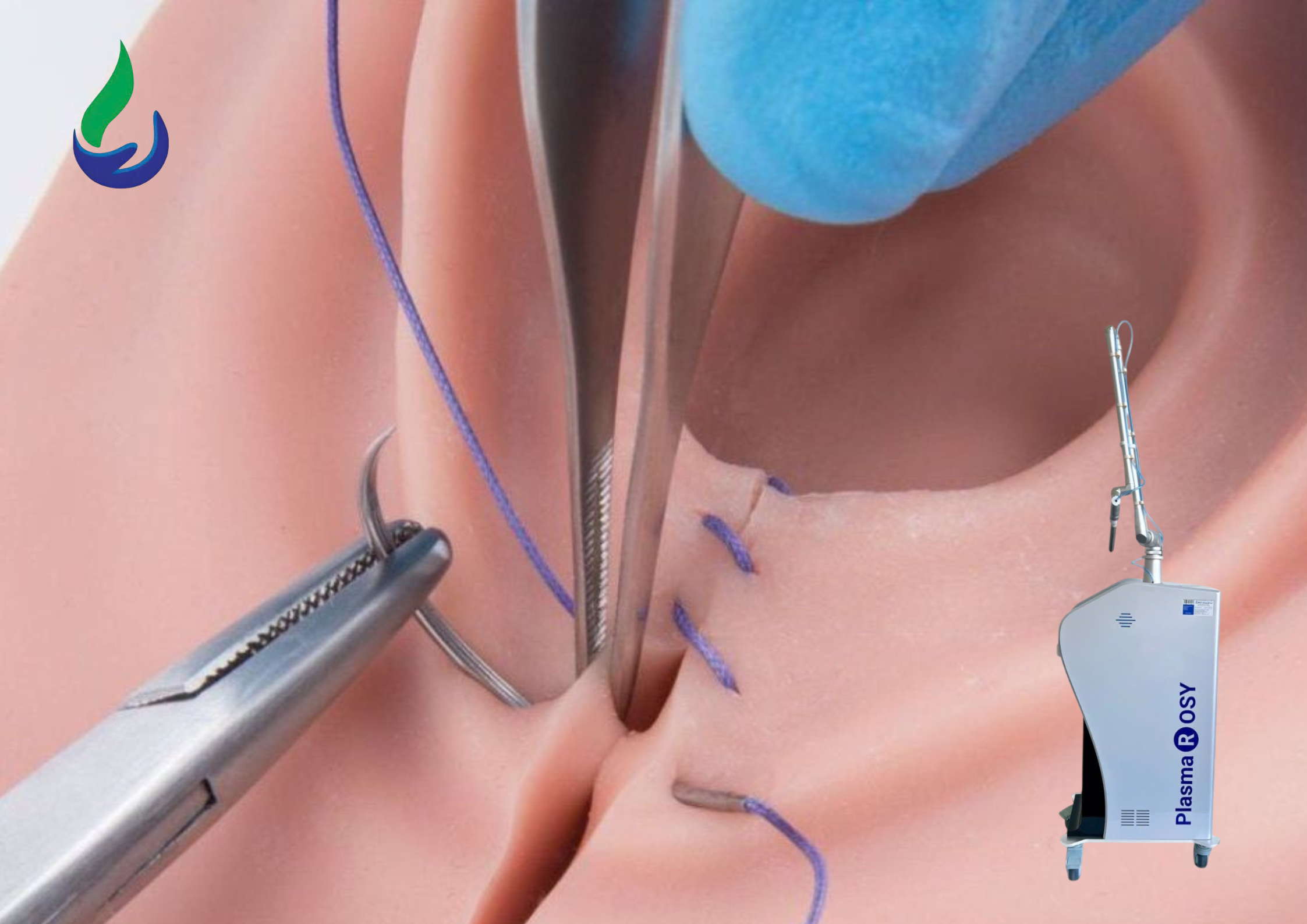 Việc chiếu PlasmaRosy ngay sau ca tiểu phẫu giúp làm dịu các mô tổn thương ngay lập tức.