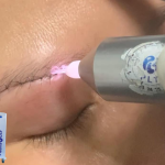 Plasma lạnh diệt vi khuẩn như thế nào theo Cơ chế khoa học ?