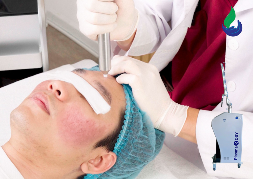 Plasma lạnh trị mụn có hiệu quả không? Cơ chế và ứng dụng trong da liễu
