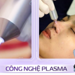 Plasma lạnh là gì? Cơ chế và ứng dụng trong da liễu hiện đại