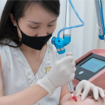 Plasma lạnh phục hồi da sau laser như thế nào?