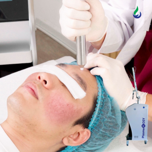 Mụn Viêm Nặng, Mụn Kháng Kháng Sinh Và Phục Hồi Da Sau Laser: Vai Trò Của Plasma Lạnh
