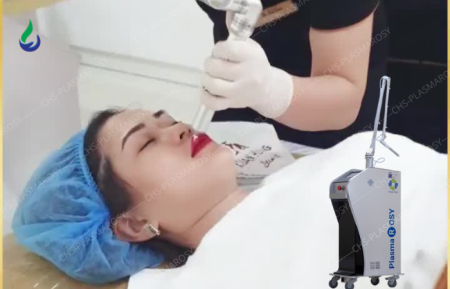 Công nghệ PlasmaRosy: vũ khí nâng tầm dịch vụ laser xóa xăm thẩm mỹ