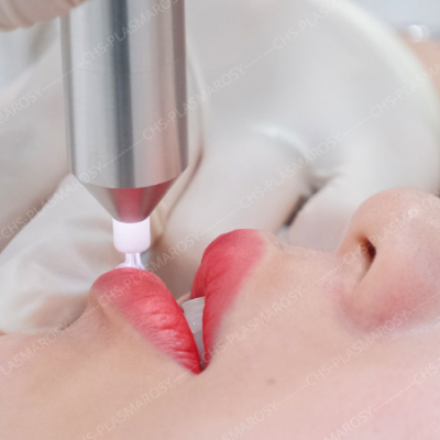 Chiếu Plasma phun xăm môi giúp phục hồi và nâng cao dịch vụ