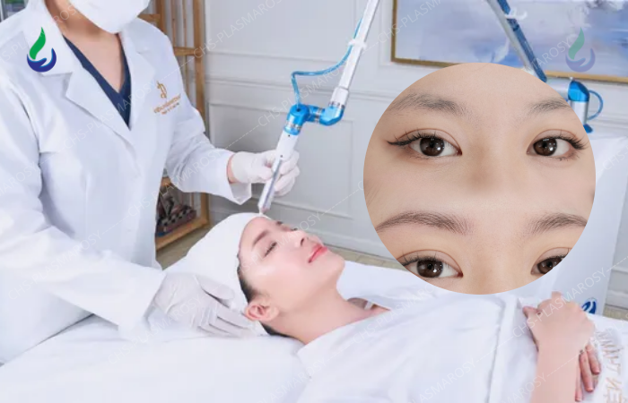 plasma lạnh chân mày có tác dụng giảm vi khuẩn trên bề mặt da