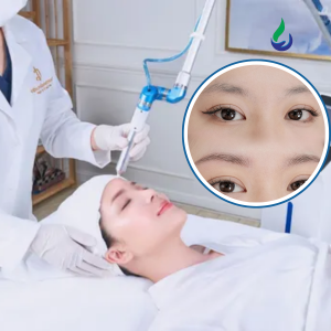 Ứng dụng Plasma lạnh phun xăm chân mày và điêu khắc, gẩy sợi