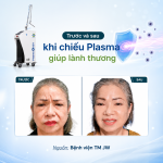 Giải pháp lành thương thẩm mỹ: Từ phòng mổ, da liễu đến phun xăm