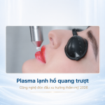 Plasma lạnh hồ quang trượt – Công nghệ đón đầu xu hướng thẩm mỹ 2026