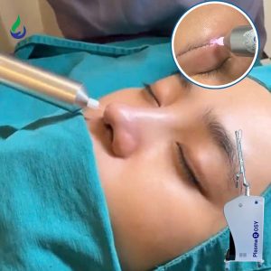 Công Nghệ Plasma Hồ Quang Trượt (GAP) Là Gì? Vì Sao PlasmaRosy® Được Nhiều Clinic Lựa Chọn?